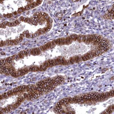 Immunohistochemistry-Paraffin: Septin-9 Antibody [NBP2-13294]