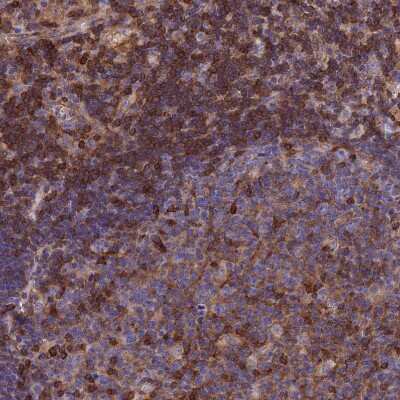 Immunohistochemistry-Paraffin: Septin-9 Antibody [NBP2-13294]