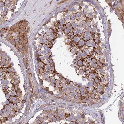 Immunohistochemistry-Paraffin: Septin-9 Antibody [NBP2-13294]
