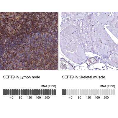 Immunohistochemistry-Paraffin: Septin-9 Antibody [NBP2-13294]