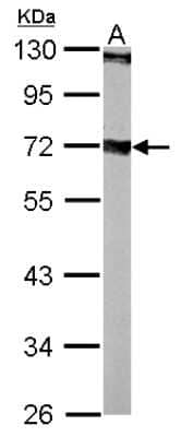 Western Blot: Septin-9 Antibody [NBP2-20303]