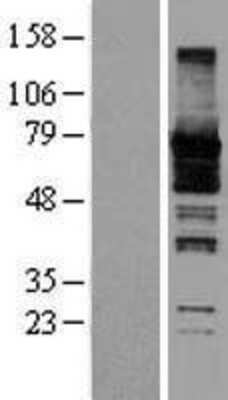 Western Blot: Septin-9 Overexpression Lysate [NBL1-07150]