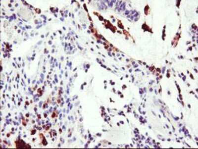 Immunohistochemistry-Paraffin: Serine Dehydratase Antibody (OTI3D3) [NBP2-01506]