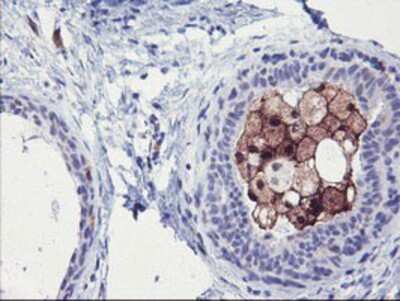 Immunohistochemistry-Paraffin: Serine Dehydratase Antibody (OTI3D3) [NBP2-01506]
