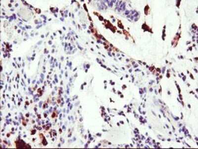 Immunohistochemistry: Serine Dehydratase Antibody (OTI3D3) - Azide and BSA Free [NBP2-74074]