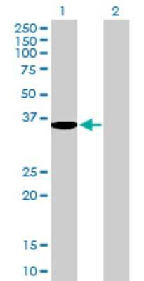Western Blot: Serine Dehydratase Antibody [H00010993-B01P]