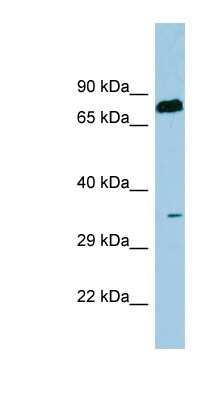 Western Blot: Serine Dehydratase Antibody [NBP1-56667]