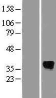 Western Blot: Serine Dehydratase Overexpression Lysate [NBP2-10397]