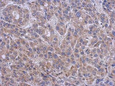 Immunohistochemistry-Paraffin: Serine Palmitoyltransferase 2 Antibody [NBP2-20308]