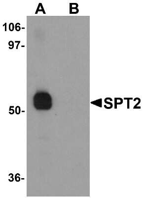 Western Blot: Serine Palmitoyltransferase 2 AntibodyBSA Free [NBP1-76573]