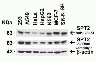 Western Blot: Serine Palmitoyltransferase 2 AntibodyBSA Free [NBP1-76573]