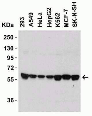 Western Blot: Serine Palmitoyltransferase 2 AntibodyBSA Free [NBP1-76573]