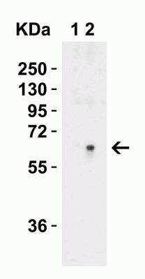 Western Blot: Serine Palmitoyltransferase 2 AntibodyBSA Free [NBP1-76573]