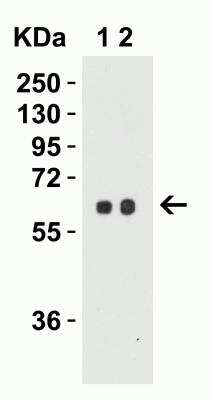 Western Blot: Serine Palmitoyltransferase 2 AntibodyBSA Free [NBP1-76573]