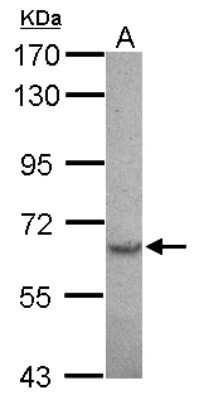 Western Blot: Serine Palmitoyltransferase 2 Antibody [NBP2-20308]