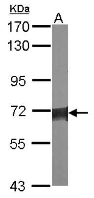 Western Blot: Serine Palmitoyltransferase 2 Antibody [NBP2-20308]