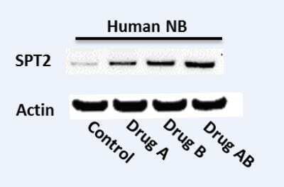 Western Blot: Serine Palmitoyltransferase 2 Antibody [NBP2-20308]