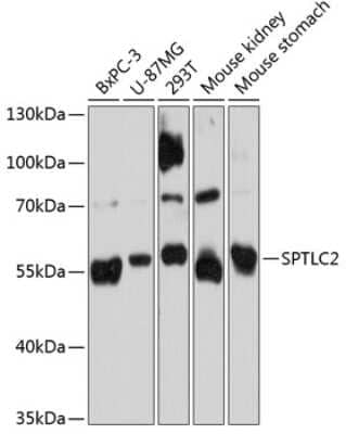 Western Blot: Serine Palmitoyltransferase 2 AntibodyAzide and BSA Free [NBP2-93707]