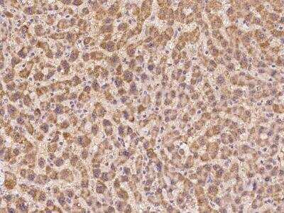 Immunohistochemistry-Paraffin: Serine protease 23 Antibody [NBP3-06049]