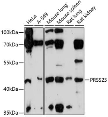 Western Blot: Serine protease 23 AntibodyAzide and BSA Free [NBP2-93072]