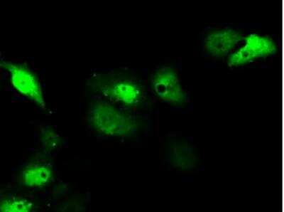 Immunocytochemistry/ Immunofluorescence: Serine racemase Antibody (OTI2E3) [NBP2-02332]