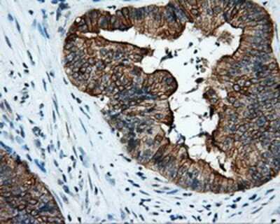 Immunohistochemistry-Paraffin: Serine racemase Antibody (OTI2E3) [NBP2-02332]