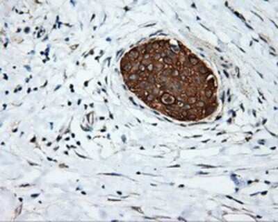Immunohistochemistry-Paraffin: Serine racemase Antibody (OTI2E3) [NBP2-02332]