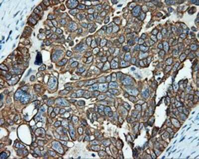 Immunohistochemistry-Paraffin: Serine racemase Antibody (OTI2E3) [NBP2-02332]