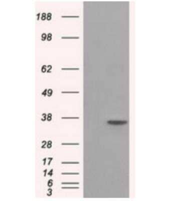 Western Blot: Serine racemase Antibody (OTI2E3) [NBP2-02332]