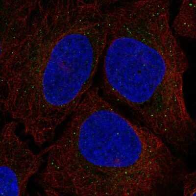 Immunocytochemistry/ Immunofluorescence: Serine racemase Antibody [NBP2-58903]