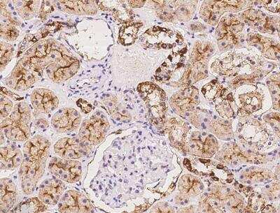 Immunohistochemistry-Paraffin: Serine racemase Antibody [NBP3-06588]