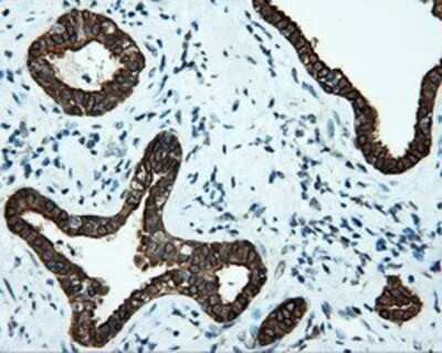 Immunohistochemistry: Serine racemase Antibody (OTI2E3) - Azide and BSA Free [NBP2-74083]