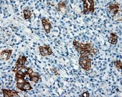Immunohistochemistry: Serine racemase Antibody (OTI2E3) - Azide and BSA Free [NBP2-74083]
