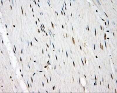 Immunohistochemistry: Serine racemase Antibody (OTI2E3) - Azide and BSA Free [NBP2-74083]