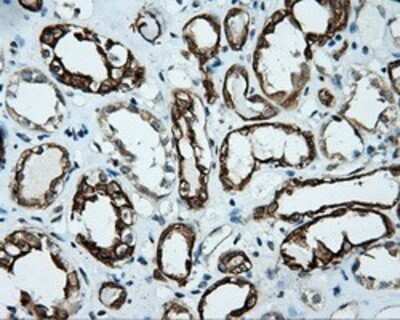 Immunohistochemistry: Serine racemase Antibody (OTI2E3) - Azide and BSA Free [NBP2-74083]