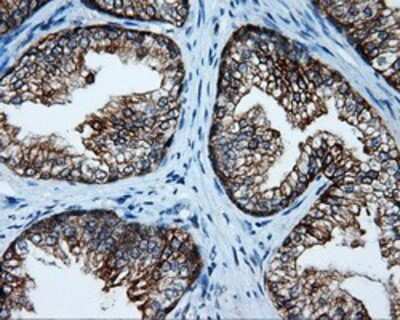 Immunohistochemistry: Serine racemase Antibody (OTI2E3) - Azide and BSA Free [NBP2-74083]