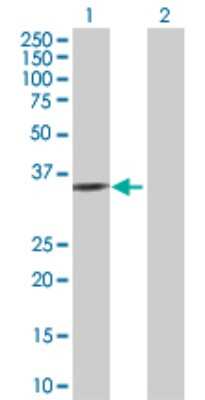 Western Blot: Serine racemase Antibody [H00063826-D01P]