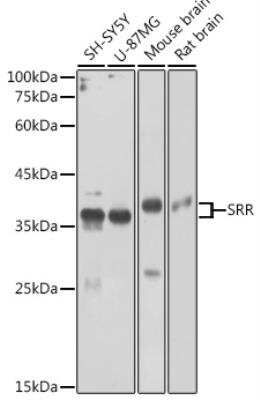 Western Blot: Serine racemase AntibodyBSA Free [NBP2-93173]