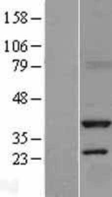 Western Blot: Serine racemase Overexpression Lysate [NBL1-16460]