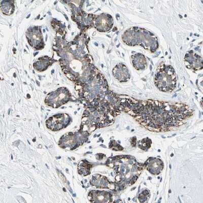 Immunohistochemistry-Paraffin: Serine/threonine-protein kinase NIM1 Antibody [NBP2-14254]