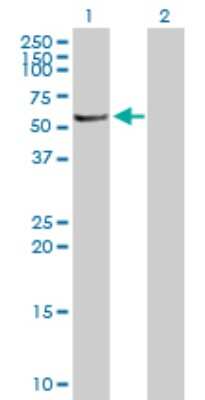 Western Blot: Serine/threonine-protein kinase NIM1 Antibody [H00167359-B01P]