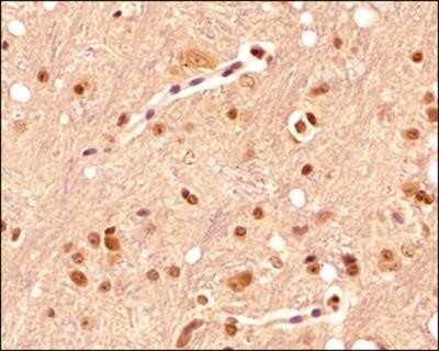 Immunohistochemistry: Serotonin Antibody (YC5/45) - Azide and BSA Free [NBP2-80946]