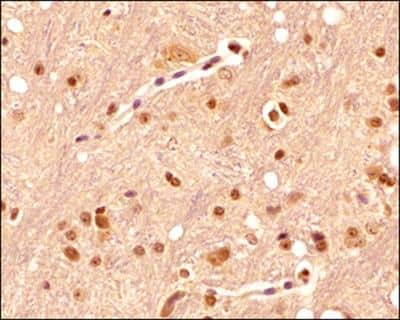 Immunohistochemistry-Paraffin: Serotonin Antibody (YC5/45) - BSA Free [NB100-65037]