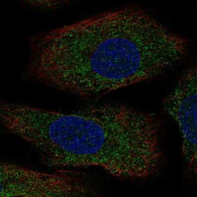 Immunocytochemistry/ Immunofluorescence: Serotonin N-acetyltransferase Antibody [NBP2-55364]