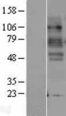 Western Blot: SLC6A4/5-HTTLPR/Serotonin transporter Overexpression Lysate [NBP2-04189]