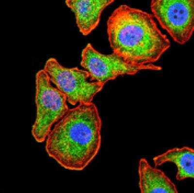 Immunocytochemistry/ Immunofluorescence: Serpin A1/alpha 1-Antitrypsin Antibody (5D1D2) - BSA Free [NBP2-52557]