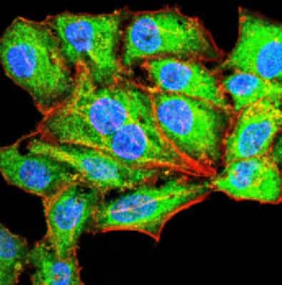 Immunocytochemistry/ Immunofluorescence: Serpin A1/alpha 1-Antitrypsin Antibody (5D1D2) - BSA Free [NBP2-52557]