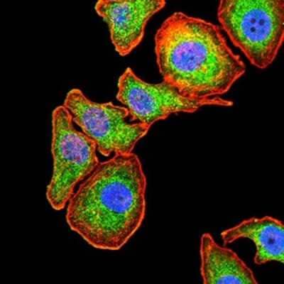 Immunocytochemistry/ Immunofluorescence: Serpin A1/alpha 1-Antitrypsin Antibody (5D1D2) - BSA Free [NBP2-52557]