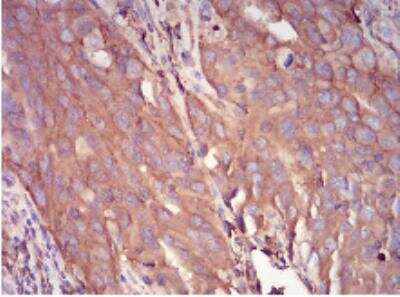 Immunohistochemistry-Paraffin: Serpin A1/alpha 1-Antitrypsin Antibody (5D1D2) - BSA Free [NBP2-52557]