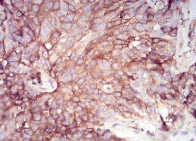 Immunohistochemistry-Paraffin: Serpin A1/alpha 1-Antitrypsin Antibody (5D1D2) - BSA Free [NBP2-52557]